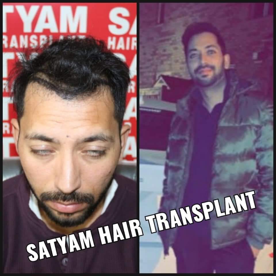 Hair Transplant Conference Images