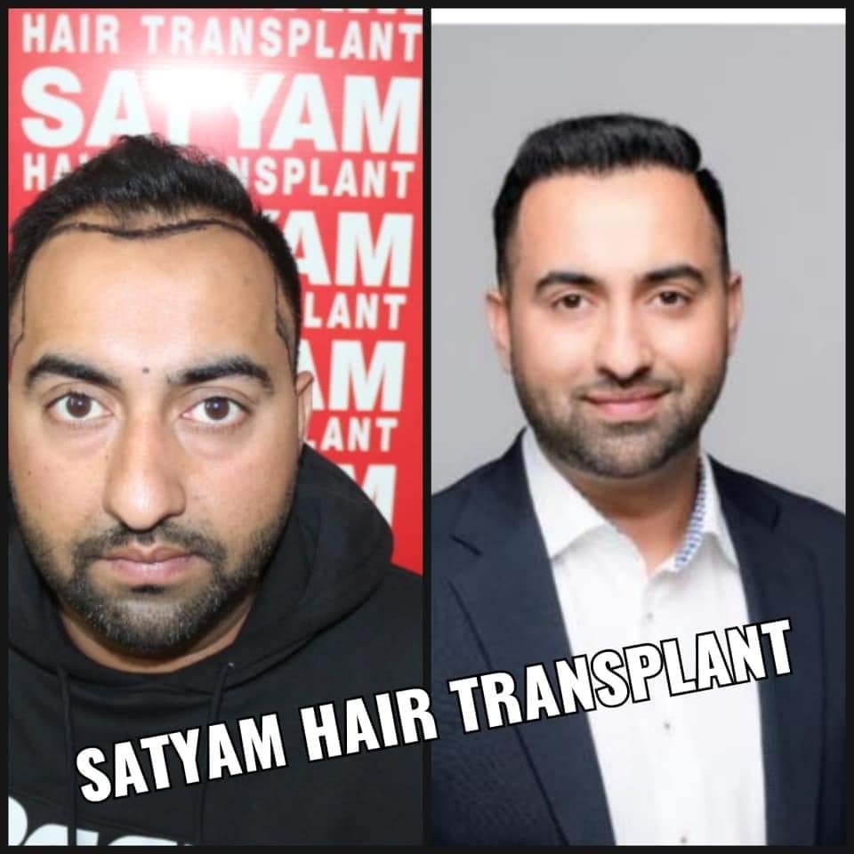 Hair Transplant Conference Images