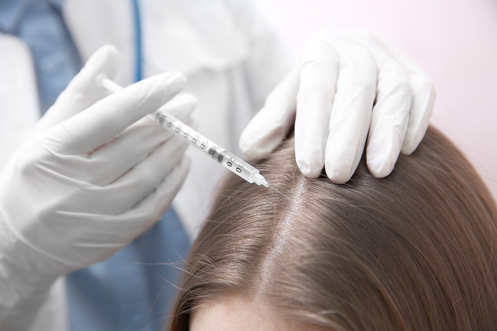 Hair Transplant Results